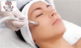 1 Session of Medical Microdermabrasion