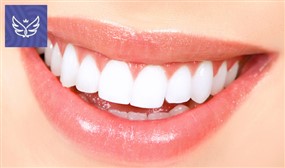 Teeth Whitening Treatment for 1 or 2 People 