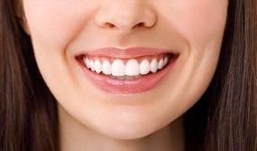 Teeth Whitening Treatment for 1 or 2 People 